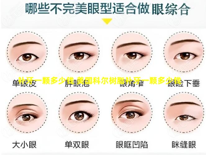 补牙一颗多少钱 美国科尔树脂补牙一颗多少钱
